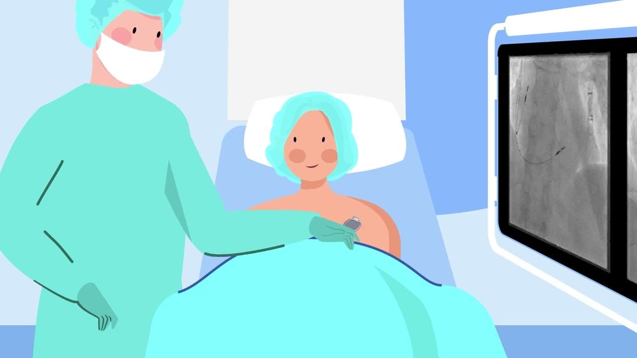 Vidéo: GHBS – motion design Rythmologie - Selltim Agence Web et Communication